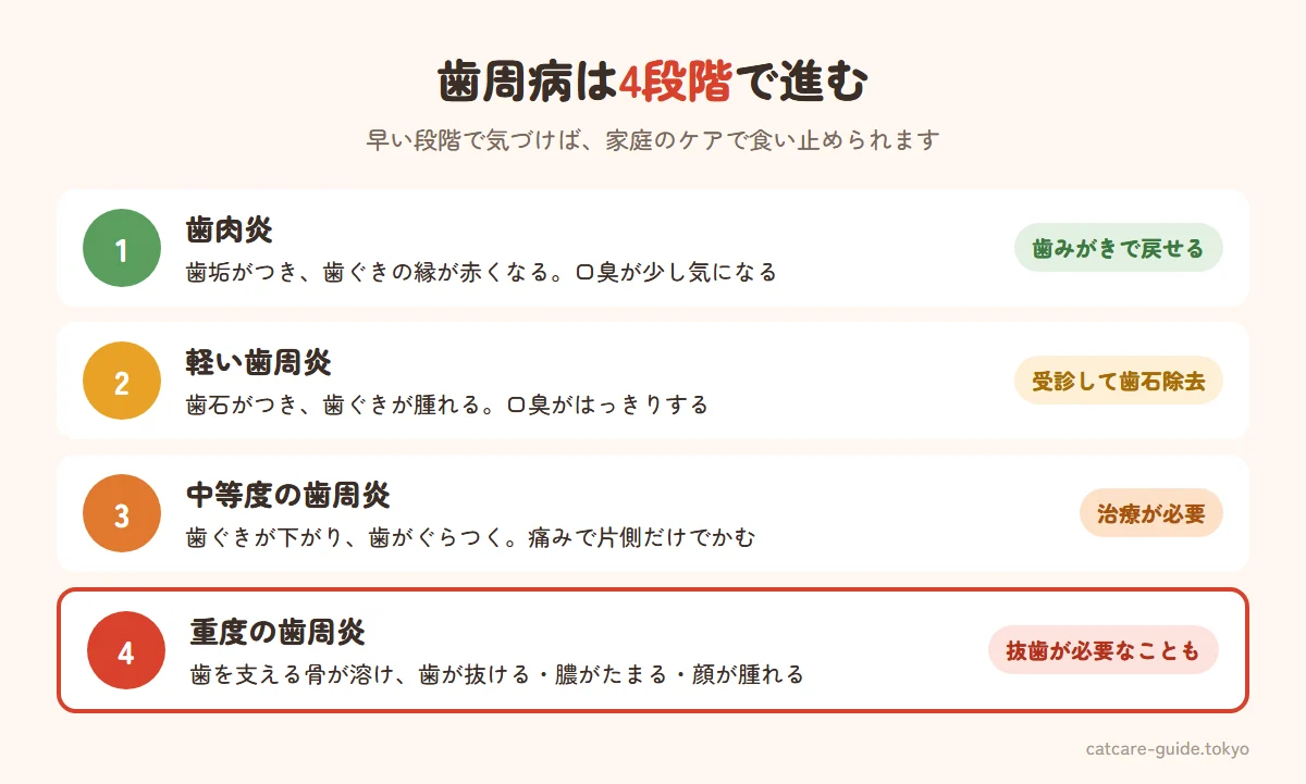 猫の歯周病の進行4段階。第1段階は歯垢がつき歯ぐきの縁が赤くなる歯肉炎で歯みがきで戻せる、第2段階は歯石がつき口臭が強くなる、第3段階は歯ぐきが下がり歯がぐらつき痛みで食べにくくなる、第4段階は歯を支える骨が溶け歯が抜ける・膿がたまる